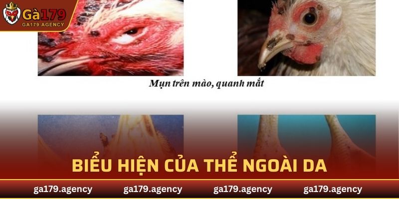 Biểu hiện của thể ngoài da